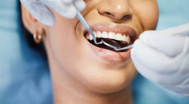 Best Affordable Emergency Dental Care  in Santa Venetia, CA